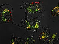 Dankzij sferische nucleïnezuren was de verbinding 5-fluorouracil 20.000 keer effectiever dan normaal in dierstudies. (Afbeeldingsbron: Northwestern University)