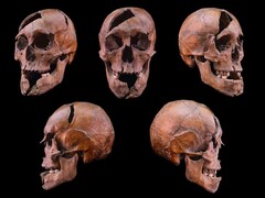 De schedel van het onderzochte individu uit het 13e-eeuwse dominicanenklooster op Margaretha-eiland, Boedapest (Afbeelding Credit: Eötvös Loránd Universiteit)