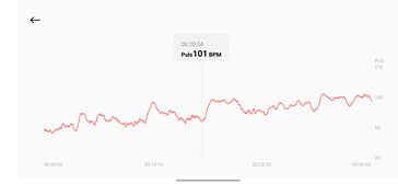 Hartslagmeting met de Xiaomi Smart Band 10 Pro