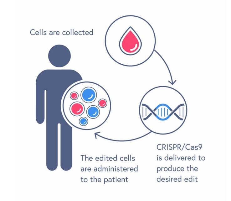 CASGEVY behandelingsproces omvat het transfuseren van bewerkte bloedstamcellen. (Bron: CRISPR Therapeutics)