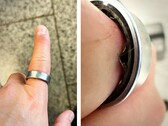 Een Samsung Galaxy Ring met een opgezwollen batterij dwong een gebruiker om naar het ziekenhuis te gaan. (Afbeeldingsbron: Zone of Tech)