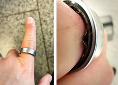 Een Samsung Galaxy Ring met een opgezwollen batterij dwong een gebruiker om naar het ziekenhuis te gaan. (Afbeeldingsbron: Zone of Tech)