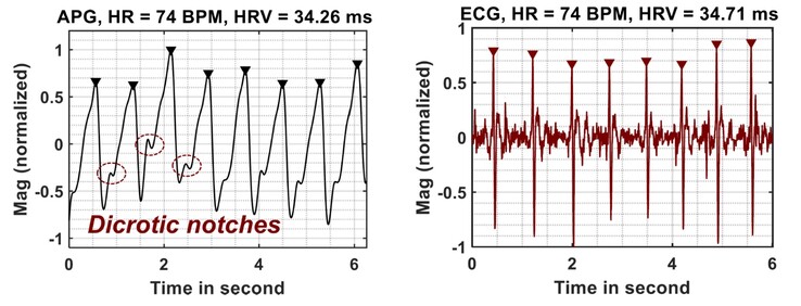 APG metingen steken gunstig af bij die van ECG (Afbeelding Bron: Google Research)