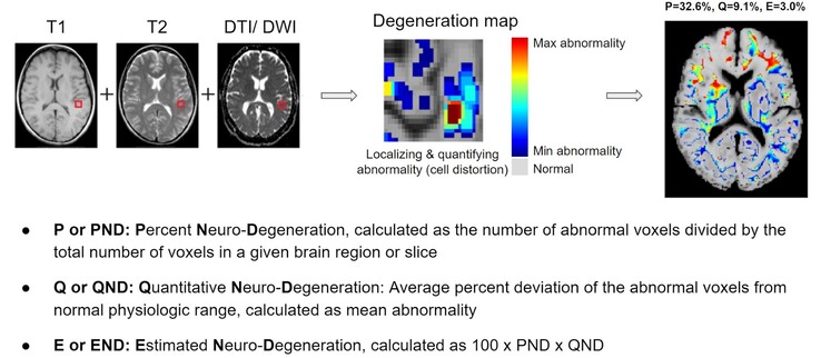 BrainSee kan van een MRI-scan afwijkende gebieden in de hersenen detecteren en artsen een score geven die aangeeft hoe groot de kans is dat een patiënt Alzheimer ontwikkelt. (Bron: Darmiyan)