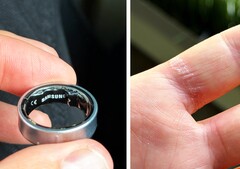 Een opgezwollen batterij in een Galaxy Ring kan pijnlijk zijn. (Afbeeldingsbron: Zone of Tech)