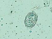 Toxoplasma gondii hier afgebeeld in zijn besmettelijke eivorm. (Afbeeldingsbron: Todorean Gabriel/iStock/Getty Images Plus)