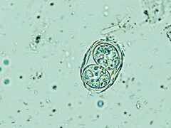 Toxoplasma gondii hier afgebeeld in zijn besmettelijke eivorm. (Afbeeldingsbron: Todorean Gabriel/iStock/Getty Images Plus)