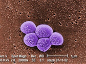 Integrated Biosciences ontdekt nieuwe klasse antibiotica die effectief zijn tegen resistente MRSA-bacteriën. (Bron: Public Health Image Library #9994)