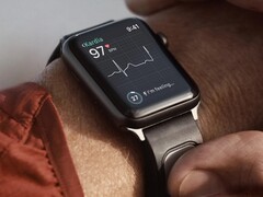 De KardiaBand is een ECG-monitoringband ontworpen voor de Apple Watch. (Afbeeldingsbron: Kardia)