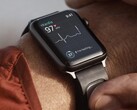 De KardiaBand is een ECG-monitoringband ontworpen voor de Apple Watch. (Afbeeldingsbron: Kardia)