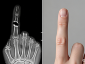 Bone Biologics dient octrooi in voor nieuwe botregeneratietechnologie (Afbeeldingsbron: AI-gegenereerde illustratieve afbeelding)