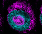 Een ingesloten kankercel (foto) - de magentakleurige mitochondriën zijn te zien in de cyaankleurige nucleaire periferie en binnen de nucleaire inkepingen. (Bron afbeelding/caption: Rito Ghose en Fabio Pezzano/Centro de Regulación Genómica)