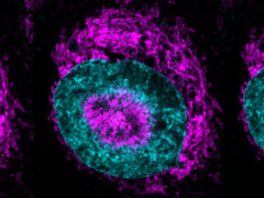 Een ingesloten kankercel (foto) - de magentakleurige mitochondriën zijn te zien in de cyaankleurige nucleaire periferie en binnen de nucleaire inkepingen. (Bron afbeelding/caption: Rito Ghose en Fabio Pezzano/Centro de Regulación Genómica)