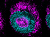 Een ingesloten kankercel (foto) - de magentakleurige mitochondriën zijn te zien in de cyaankleurige nucleaire periferie en binnen de nucleaire inkepingen. (Bron afbeelding/caption: Rito Ghose en Fabio Pezzano/Centro de Regulación Genómica)