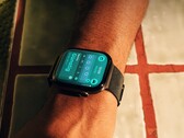 Sommige gebruikers hebben last van huidirritatie door de Apple Watch Series 12.