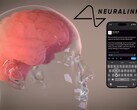 De visie van Neuralink: volledige controle over digitale apparaten door te denken (Afbeelding Bron: Neuralink)