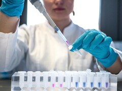 Oxford BioTherapeutics en Roche kondigen strategisch partnerschap aan voor kankertherapeutica (bron: Julia Koblitz, Unsplash)