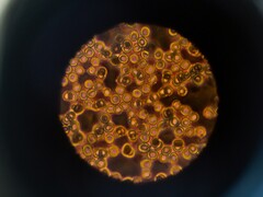 Bloedcellen onder een microscoop (Afbeelding bron: ThisisEngineering via Unsplash; bijgesneden)