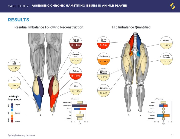 De rapporten van Springbok Analytics geven gedetailleerde informatie over individuele spieren via 3D MRI-scans. (Bron: Springbok Analytics)