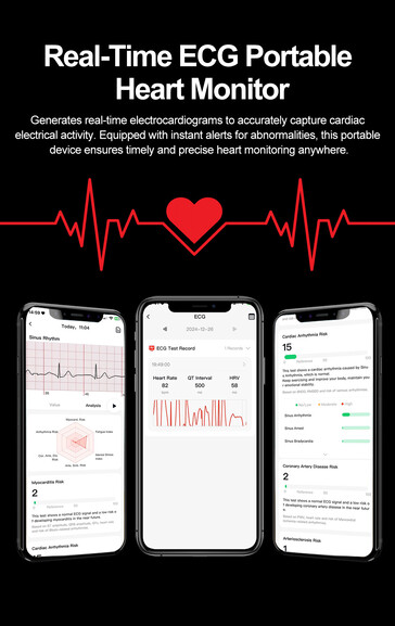 (Afbeeldingsbron: Rogbid)