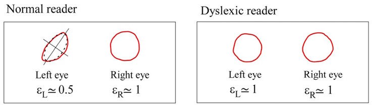 Maxwells centroïden verschillen in symmetrie bij normale proefpersonen, maar zijn vergelijkbaar bij dyslectische proefpersonen. (Afbeeldingsbron: DOI 10.3390/brainsci13101478) 