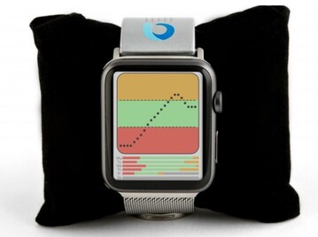 Concept met de monitor geïntegreerd met een Apple Watch. (Afbeelding bron: Iterate)