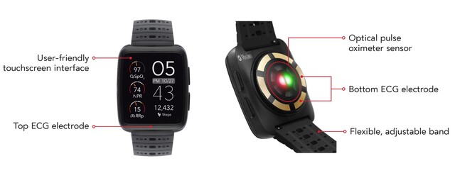 Het Masimo W1 horloge is ontworpen voor constante controle van SpO2 en andere vitale functies. (Bron: Masimo)