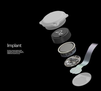 De verschillende onderdelen van het Neuralink implantaat. (Bron: Neuralink)